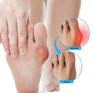 ครีมบำรุงนิ้วเท้า บรรเทาอาการปวดข้อ ลดอาการบวม เพิ่มการเคลื่อนไหวของข้อ - Product Image 5
