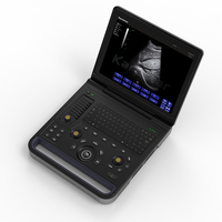 Scanner à ultrasons portable à faible coût de 15 pouces Système de diagnostic médical vétérinaire Échographie échographique
