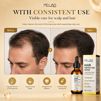 Serum Pertumbuhan Rambut Redensyl Saw Palmetto Biotin Kafein Serum Kulit Kepala Penyegar Folikel Penguat Akar Rambut Peptida Ghk-cu Serum Rambut
