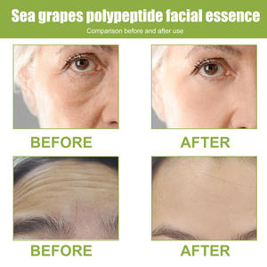 Ot-suero antiarrugas para la piel del rostro, suero compacto antiarrugas antienvejecimiento, Ley de desalinización facial que produce arrugas - Product Image 5