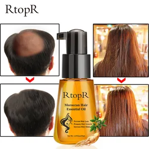 Marocchino prevenire la caduta dei capelli prodotto olio essenziale per la crescita dei capelli facile da trasportare cura dei capelli infermieristica 35ml sia maschio che femmina può essere utilizzato