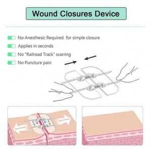 Cheap Kid Friendly Sleeping Sleep Disinfecting Mouth <b>Tape</b> Strips - Product Image 1