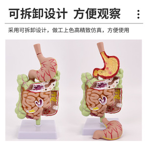 Modelo patológico del colon humano, modelo anatómico gastrointestinal, modelo patológico de colon, cecum, recto y duodeno - Product Image 2