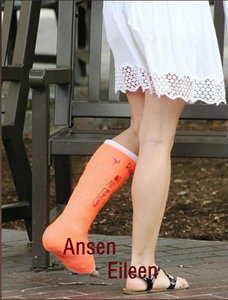 Bande de plâtre en <span class=keywords><strong>fibre</strong></span> médicale de haute qualité pour fractures, bandage en <span class=keywords><strong>fibre</strong></span> de verre orthopédique - Product Image 5