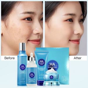 Produits de soin de la peau à l'acide hyaluronique, crème pour le visage, sérum hydratant, crème anti-âge, ensemble de soins de la peau à étiquette privée - Product Image 5