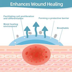 YOJO แผ่นปิดแผลไฮโดรคอลลอยด์แบบม้วน ขนาดและรูปทรงปรับได้ ติดด้วยตัวเอง ผ่านการฆ่าเชื้อ EO สำหรับดูแลบาดแผล แผลไฟไหม้ แผลพุพอง และสิว - Product Image 2