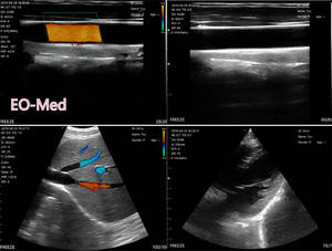 3 in 1 Portable <strong>Wireless</strong> <strong>Ultrasound</strong> <strong>Probe</strong> Type Scanner <strong>Ultrasound</strong> Device Attractive Price DCU19G