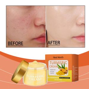 Crema Facial y Corporal de Cúrcuma con Vitamina E Natural, Blanqueadora, Antiarrugas, Antienvejecimiento, para el Acné y las Manchas Oscuras, Hidratante, Venta al por Mayor - Product Image 2