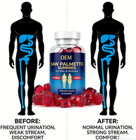 Gummies de palmier nain 60 unités |   Complément alimentaire pour la santé de la prostate à la saveur de framboise pour hommes et femmes |   Soutient la fonction des voies urinaires