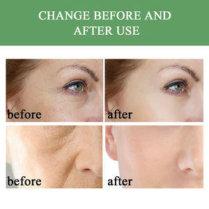 Crème anti-âge QBEKA avec coenzyme, minimise les pores, réduit les rides, apaise et hydrate la peau, beauté propre - Product Image 6