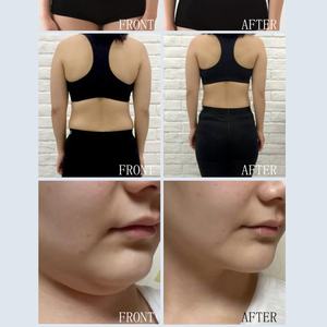 Appareil professionnel 9-en-1 de remodelage corporel, amincissement et raffermissement de la peau, avec poignée vibrante à thérapie magnétique pour le visage/tête, prise AU/US - Product Image 6