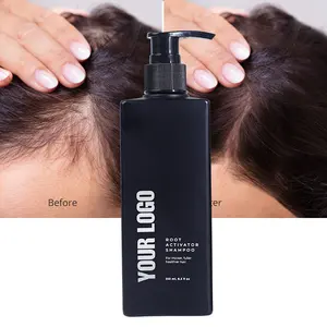 Özel etiket biberiye zencefil kökü aktive şampuan Anti saç dökülmesi organik şampuan Biotin saç derisi bakımı doğal şampuan