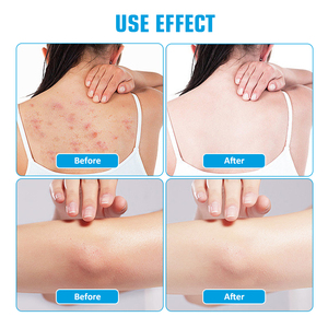 Exfoliante corporal Bump Eraser, exfoliante de piel de queratosis Pilaris, ayuda a reducir los golpes en la piel de pollo seguros para la piel sensible - Product Image 3
