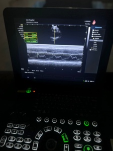 Kustomisasi jantung OB GYN mesin ecocardiografi Laptop pemindai Ultrasound portabel Ecografo Portatil - Product Image 6