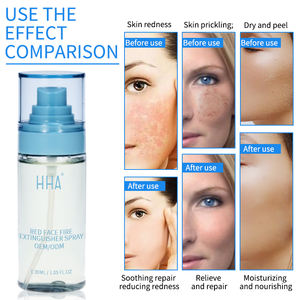 Marque privée Naturel Bio Rouge Visage Extincteur Spray <span class=keywords><strong>Toner</strong></span> Visage Spray Soins Coréens Pour La Peau Élimine Rapidement Les Rougeurs Pour Le Visage - Product Image 6