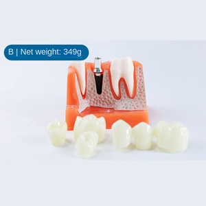 Oral Teaching Simulation Model Plastic Dental Implant with Removable <b>Teeth</b> Multi-Purpose <b>Teeth</b> <b>Whitening</b> Accessories - Product Image 3