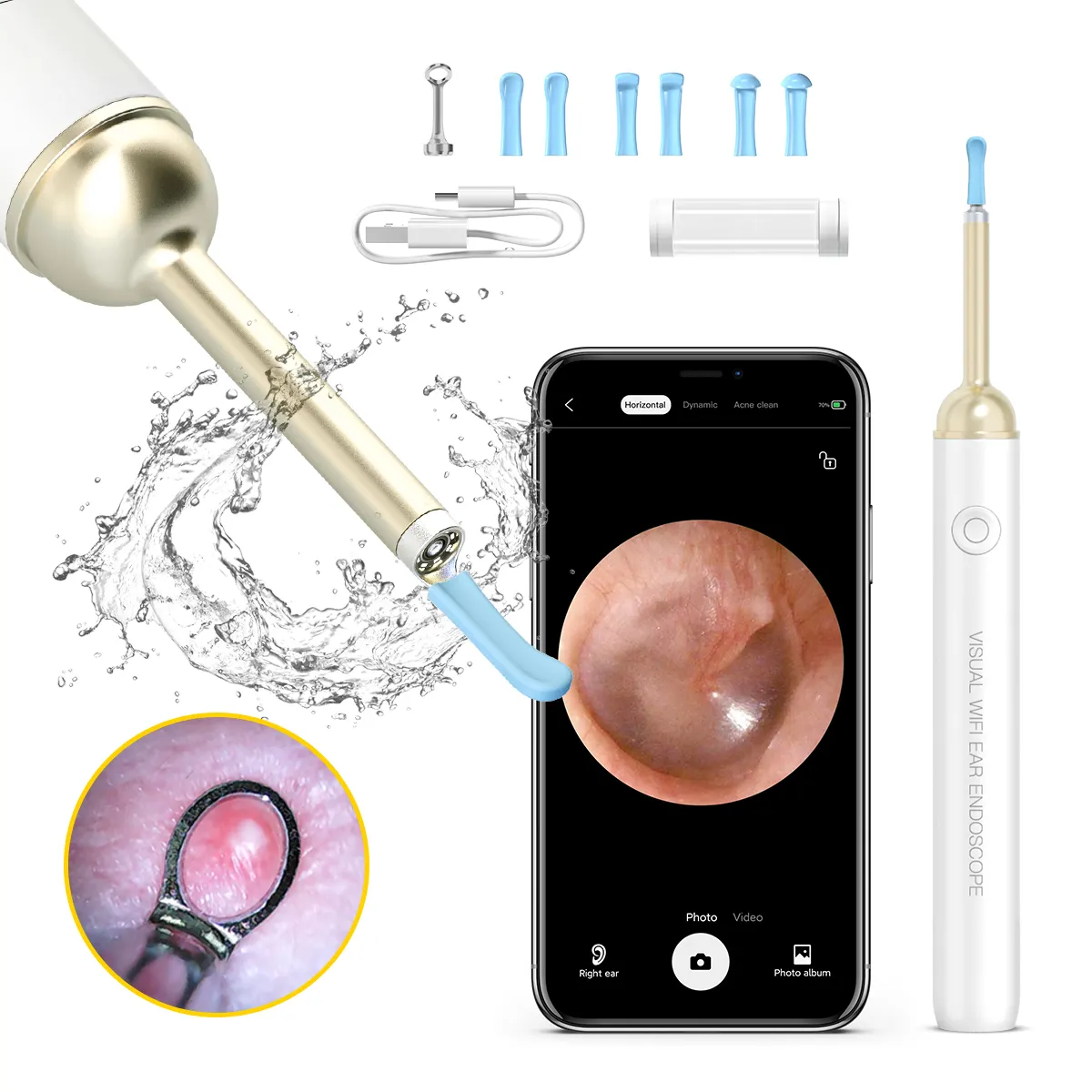 Suear 1080P 3.9mm Earwax Vacuum Cleaner Smart Visual Ear Cleaning Camera Electrical Ear Cleaner