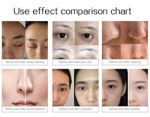 Masseur facial multifonctionnel à bulles d'oxygène 14-en-1 : anti-âge et nettoyage en profondeur, adapté aux spas. - Product Image 4