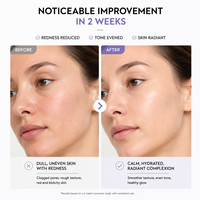 Nouveauté : Tonique à la niacinamide, céramide et acide hyaluronique, hydratant, éclaircissant, affinant les pores, apaisant les rougeurs, soin de la peau