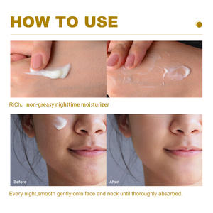 <span class=keywords><strong>Pommade</strong></span> au soufre Crème à base de soufre <span class=keywords><strong>pour</strong></span> le visage et le corps Anti Pimple Remover - Product Image 4