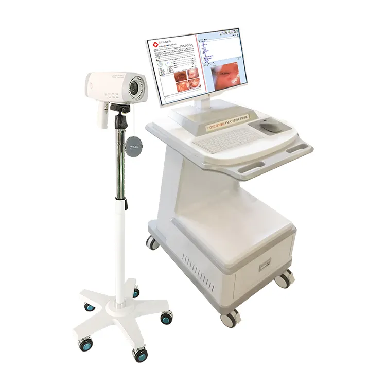 Máquina de colposcopia Digital para Vagina, equipo de colposcopio, precio barato
