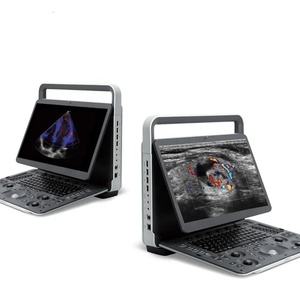Système d'échographie Doppler couleur de diagnostic Sonoscape E3V de haute qualité et à bon prix pour les hôpitaux - Product Image 4