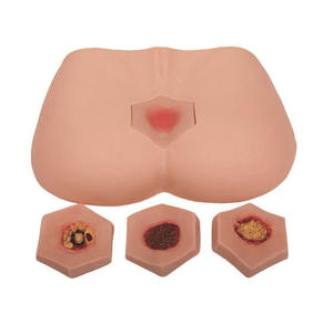Modelo de enfermagem para treinamento médico, estágio de úlcera de decúbito humano - Product Image 1