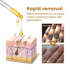 Suero para el Cuidado de la Piel JAYSUING para Aclarar, Oscurecer y Tratar las Articulaciones de Rodilla, Codo y Dedos - Product Image 2