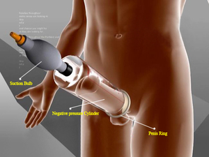 Penis pumpe Vakuumpumpe für Penis vergrößerung Männliche Panik pumpe Manueller Penis ver größerer - Product Image 2