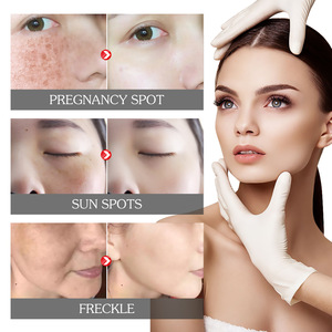 <span class=keywords><strong>Crème</strong></span> Correctrice de Pigmentation EELHOE Marque Privée, <span class=keywords><strong>Crème</strong></span> <span class=keywords><strong>Anti</strong></span>-Taches pour le Visage, <span class=keywords><strong>Crème</strong></span> <span class=keywords><strong>Anti</strong></span>-Taches de Rousseur, Élimination du Mélasma - Product Image 3