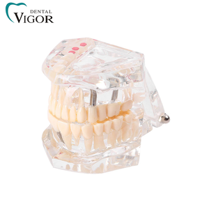 Modèle dentaire transparent pour l'enseignement de la pathologie dentaire avec dents amovibles pour la démonstration de prothèses - Product Image 1