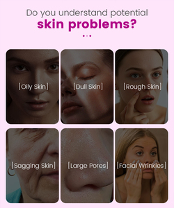 Appareil facial <span class=keywords><strong>O2</strong></span>, rajeunissement <span class=keywords><strong>de</strong></span> la peau, resserrement du visage, dermabrasion, appareil facial - Product Image 3