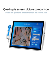 Dermatoscope pour usage domestique, diagnostic du cuir chevelu, détection de l'humidité, analyseur de peau et de cheveux avec écran