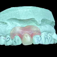 Prothèse dentaire partielle amovible en résine flexible, invisible et incassable |   pour les laboratoires ou les cliniques | Fabriqué en Chine