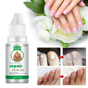 2025 Tik Tok Venta caliente Herbal Nail Foot Toe Nail Fungus Tratamiento Reparación de uñas Líquido Cuidado de los pies - Product Image 3