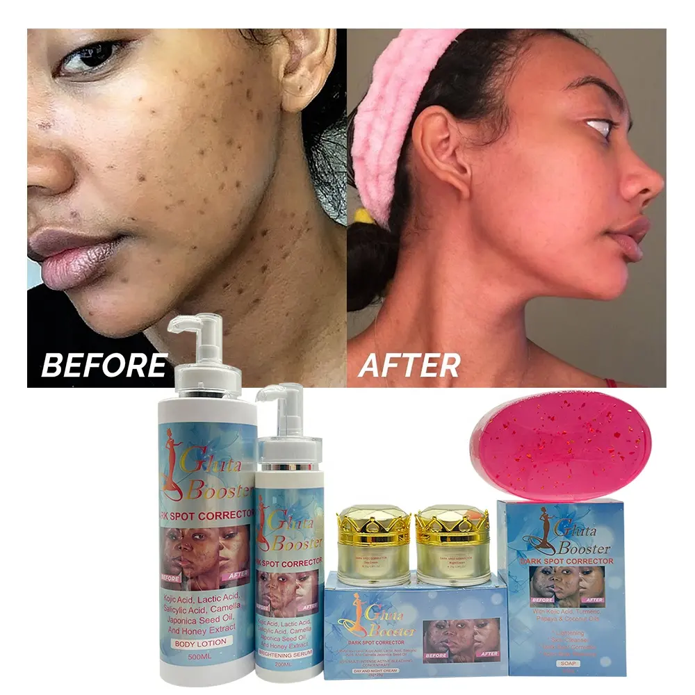 Dark Spot Corrector Remover Handelsmarke für dunkle Haut verblassen schwarze Flecken Hyper pigmentierung Klären Sie African Beauty Skincare Set