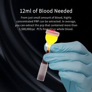 Tabung y-tube 15ml untuk kecantikan <span class=keywords><strong>Platelet</strong></span> kaya tabung perawatan <span class=keywords><strong>Plasma</strong></span> untuk rambut ortopedi tabung hewan peliharaan - Product Image 5