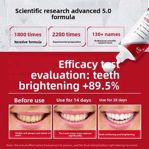 <span class=keywords><strong>Dentifrice</strong></span> Probiotique SP14 100g pour la Réparation de l'Émail, Élimination des Taches Jaunes, Haleine Fraîche Menthe, Soin Supérieur, Dentifrices Blanchissants - Product Image 2