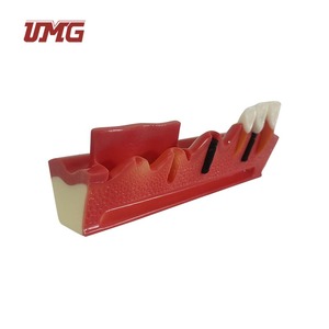 Modelo Dental Seccionado de Implantes, Material de Resina, Marca UMG con Certificación CE para Prácticas Estudiantiles - Product Image 5