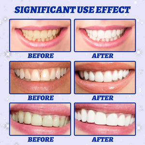 Bandes blanchissantes JAYSUING pour les dents, vente en gros, usage quotidien, bandes blanchissantes <span class=keywords><strong>5D</strong></span> pour éliminer les taches - Product Image 6