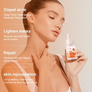 Reparación rápida y eficaz, suero facial para espinillas, acné, piel suave, reduce los poros, suero de ácido salicílico - Product Image 2