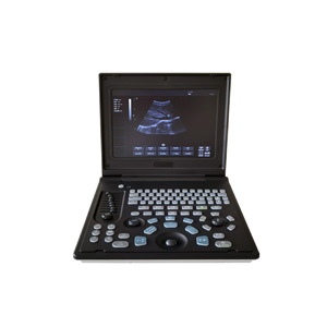 Appareil d'échographie portable de haute qualité pour usage vétérinaire, entièrement numérique, compatible avec plusieurs sondes, pour hôpital. - Product Image 2