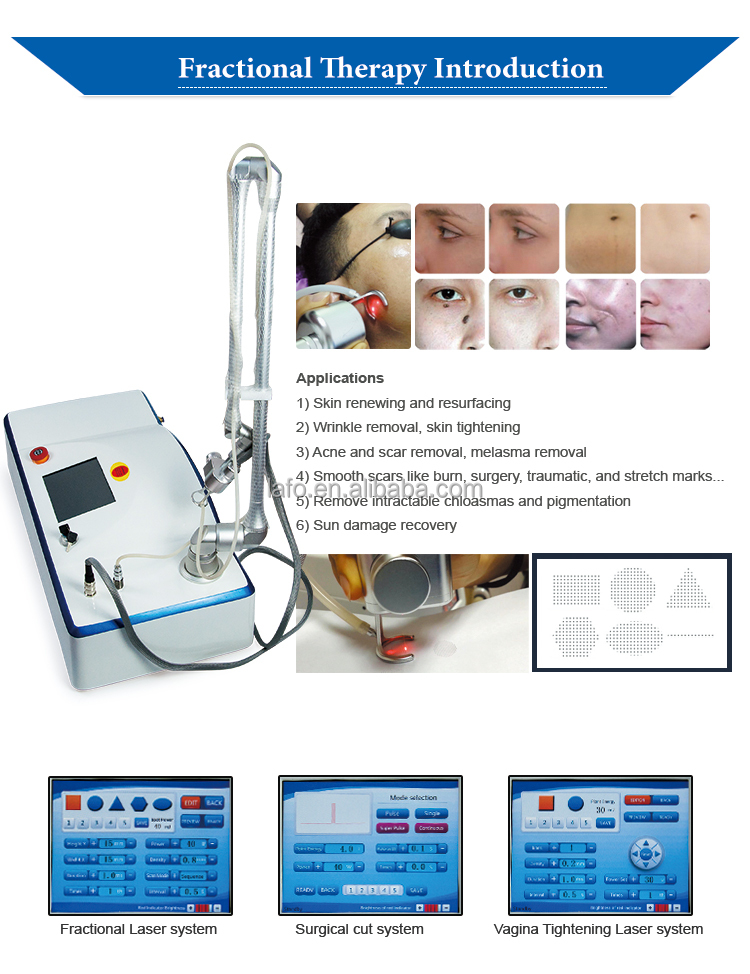 co2 l tightening laser/portable l tightening machine/fractional co2 laser l tightening machine
