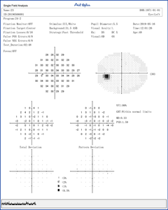 BIO-1000 CE ISO Mesin Skrining Bidang <span class=keywords><strong>Visual</strong></span> Oftalmik Perimeter Bidang <span class=keywords><strong>Visual</strong></span> Otomatis Perimeter Otomatis - Product Image 5