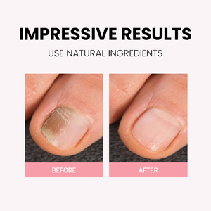 <span class=keywords><strong>Aceite</strong></span> Orgánico para el Crecimiento <span class=keywords><strong>de</strong></span> Uñas OEM para Fortalecer e Hidratar, Mezcla para el Cuidado <span class=keywords><strong>de</strong></span> las Uñas en Bolígrafo con Aceites Nutritivos <span class=keywords><strong>de</strong></span> Jojoba, Argán y Coco, <span class=keywords><strong>Aceite</strong></span> para Cutículas - Product Image 4