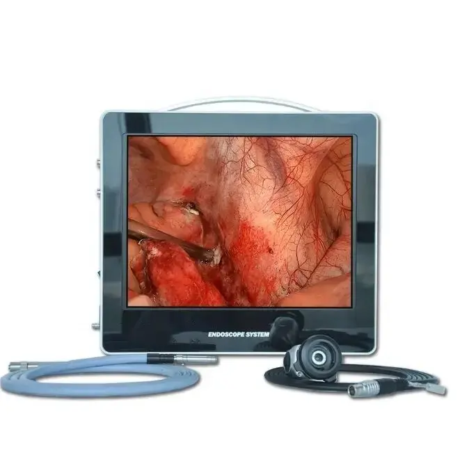 Sistema di videocamera per endoscopia a definizione Standard per endoscopio digitale portatile da 15in HD CMOS 1080p