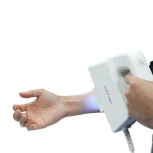 Máquina de Fototerapia Excimer UVB de Alta Intensidad de 308nm, Equipo Terapéutico Veterinario para Centro Dermatológico, Vitiligo - Product Image 2