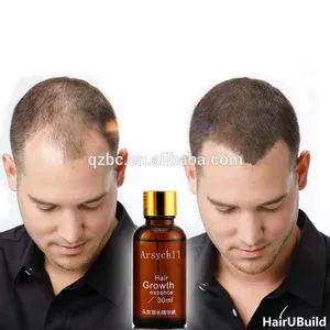 Yüksek etkili saç özü Serum erkekler kadınlar için saç bakımı besleyici yardım saç büyümek özel etiket