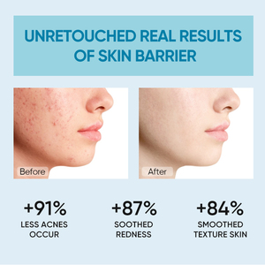 Crème Visage Hydratante Réparatrice à 5x Céramides et Acide Hyaluronique pour la Barrière Cutanée, Gel Hydratant pour Soins du Visage – Prêt à Expédier en Gros - Product Image 4