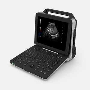 Appareil d'échographie Doppler couleur haute définition LTUB52 pour l'imagerie abdominale, <span class=keywords><strong>cardiaque</strong></span> et générale - Product Image 1